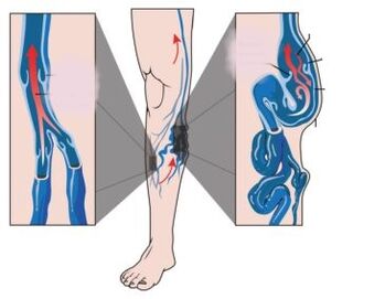 Причини, симптоми